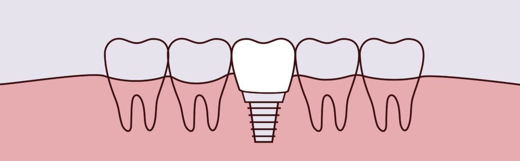 Dovey Dental -