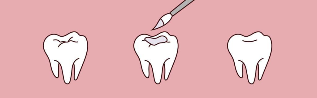 Dovey Dental -