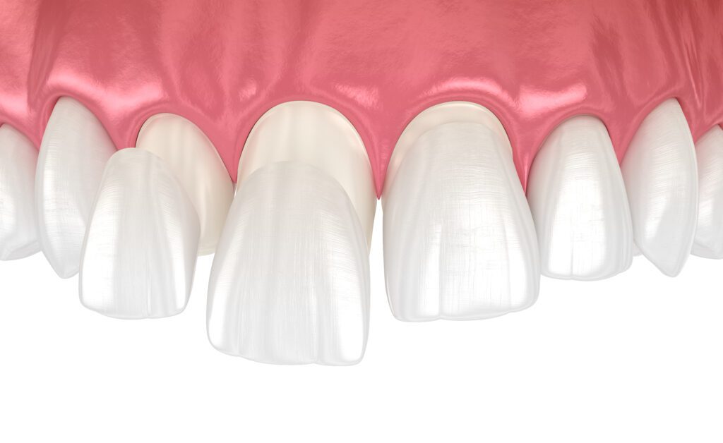 How to Choose the Best Cosmetic Dentist Near Me: 7 Things to Look For - Dovey Dental - cosmetic dentist near me